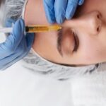 botox-tmj-treatment-in-olds-west-olds-dental